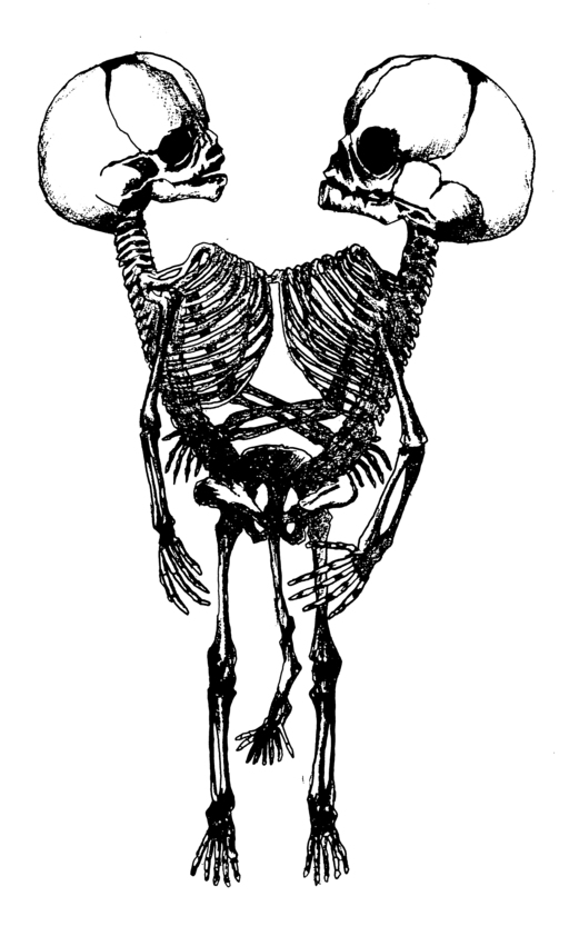 Black and white drawing of two entwined skeletons.